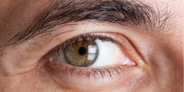 Can Thyroid Eye Disease Spread? Know The Signs, Causes, And Ways To Prevent It