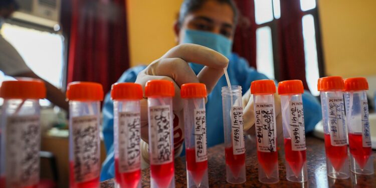 Covid Funds Fraud: ED Seizes More Than Rs 5 Cr Of Hemkunt Foundation Assets