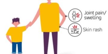 AOSD : A rare disorder