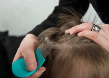 Are You Troubled By The Problem Of Lice? So You Can Get Rid Of It By Adopting These Tips!