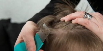 Are You Troubled By The Problem Of Lice? So You Can Get Rid Of It By Adopting These Tips!