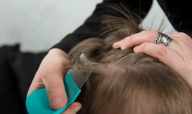 Are You Troubled By The Problem Of Lice? So You Can Get Rid Of It By Adopting These Tips!