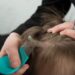 Are You Troubled By The Problem Of Lice? So You Can Get Rid Of It By Adopting These Tips!