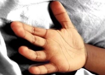 Girl Dies Due To Electrocution, 2 Of Her Friends Injured; Case Filed For Negligence On Private Power Company