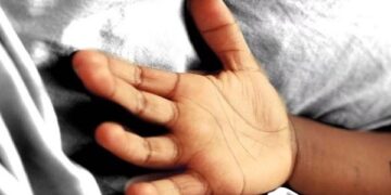 Girl Dies Due To Electrocution, 2 Of Her Friends Injured; Case Filed For Negligence On Private Power Company