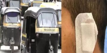 Rickshaw Driver Bites And Injures Private Transport Driver In Fare Dispute At Pune’s Swargate Bus Station