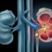Why Do Kidney Stones Start Forming? Most People Are Unaware Of These Facts