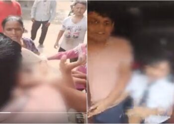 Domestic Help ‘Torture’: Girl’s Family Alleges Hot Tongs Hit Her