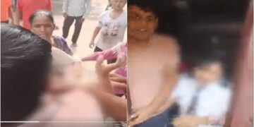 Domestic Help ‘Torture’: Girl’s Family Alleges Hot Tongs Hit Her
