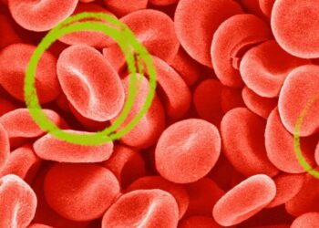 How To Boost Hemoglobin Levels In The Body Naturally Without Drugs