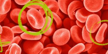 How To Boost Hemoglobin Levels In The Body Naturally Without Drugs