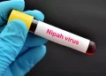 All You Need To Know In 10 Points: Nipah Virus Alert: No New Infection; Local Fruit Sale Suffers Setback