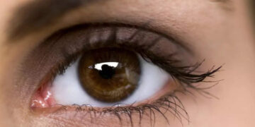 Vision