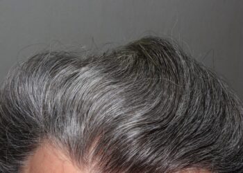 The Surprising Benefits Of Having Gray Hair