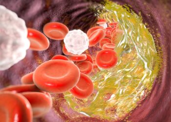 A promising method for reducing LDL cholesterol is gene editing.